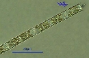 Aulacoseira granulata