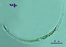 Closterium acutum