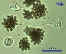 Microcystis botris