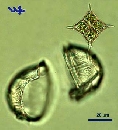 Pediastrum simplex