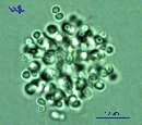 Radiocystis geminata