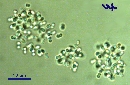 Radiocystis geminata