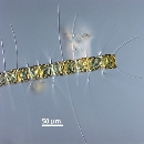 Chaetoceros lauderi