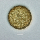 Coscinodiscus radiatus