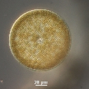 Coscinodiscus radiatus