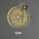 Coscinodiscus radiatus