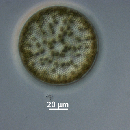 Coscinodiscus radiatus