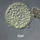 Coscinodiscus radiatus