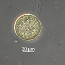 Coscinodiscus radiatus