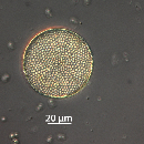 Coscinodiscus radiatus