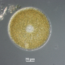 Coscinodiscus radiatus