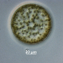 Coscinodiscus radiatus