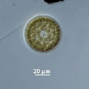 Coscinodiscus radiatus