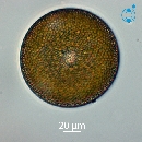 Coscinodiscus radiatus