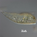 Neocalyptrella robusta