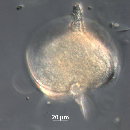 Protoperidinium depressum