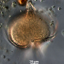 Protoperidinium depressum