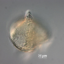 Protoperidinium depressum