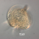 Protoperidinium depressum