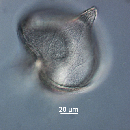 Protoperidinium depressum