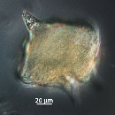 Protoperidinium depressum