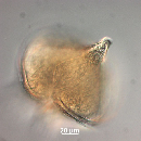 Protoperidinium depressum