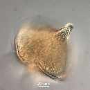 Protoperidinium depressum