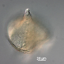 Protoperidinium depressum