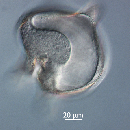 Protoperidinium depressum