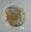 Protoperidinium depressum