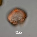 Protoperidinium obtusum