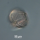 Protoperidinium obtusum