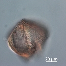 Protoperidinium obtusum