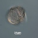 Protoperidinium obtusum