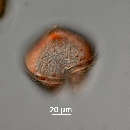 Protoperidinium obtusum