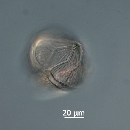 Protoperidinium obtusum