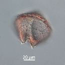 Protoperidinium obtusum