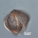 Protoperidinium obtusum