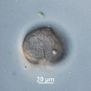 Protoperidinium obtusum