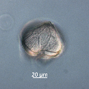 Protoperidinium obtusum