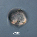 Protoperidinium obtusum