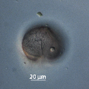 Protoperidinium obtusum