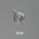 Protoperidinium steinii