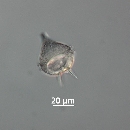 Protoperidinium steinii