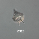 Protoperidinium steinii