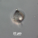 Protoperidinium steinii