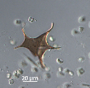 Protoperidinium stellatum