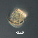 Protoperidinium subinerme