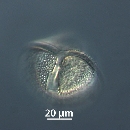 Protoperidinium subinerme