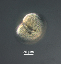 Protoperidinium subinerme